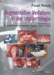 Augmentative Verfahren in der Implantologie